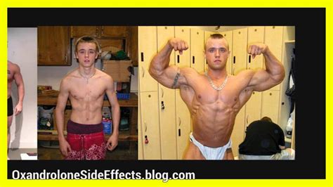 bottom growth before and after|Testosterone HRT and Bottom Growth